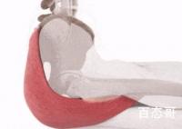 26岁女孩患上死臀综合征 到底是怎么回事