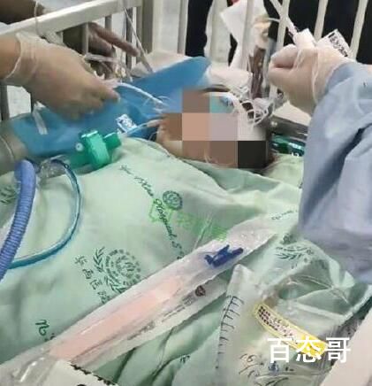 被狗咬伤女童已筹齐200万捐款 背后的真相让人始料未及